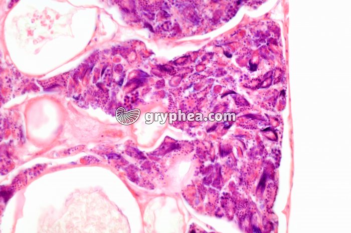 Monocystis ds Lombric x100 - gryphea.org